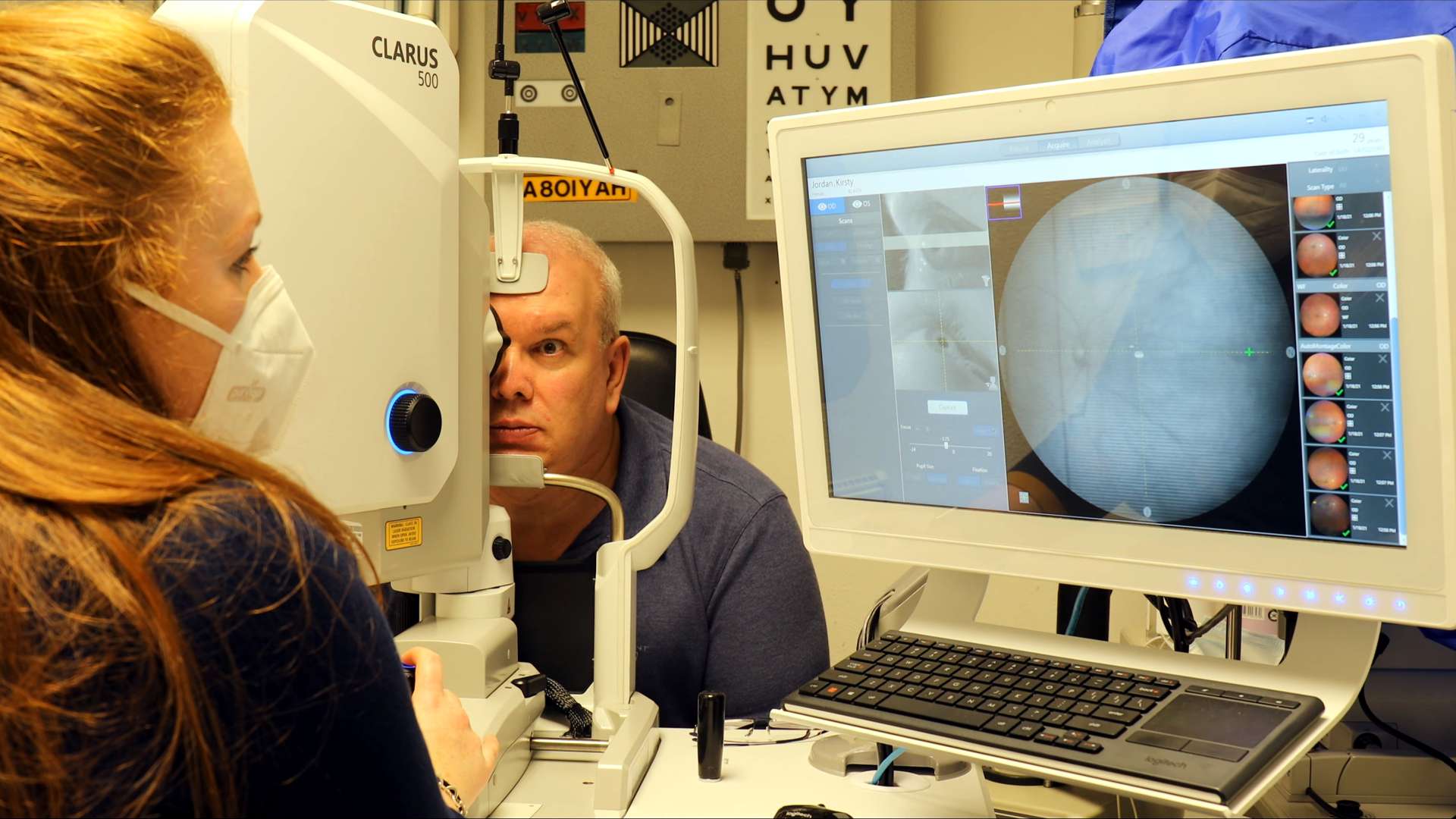 CLARUS 500 ultra wide retinal images